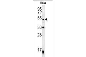 DDX47 Antibody (C-term) (ABIN652169 and ABIN2840575) western blot analysis in Hela cell line lysates (35 μg/lane). (DDX47 antibody  (C-Term))