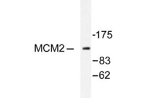 Image no. 1 for anti-Minichromosome Maintenance Complex Component 2 (MCM2) antibody (ABIN265514) (MCM2 antibody)