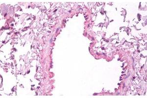 Anti-VEGF antibody IHC staining of human lung, vascular endothelium. (VEGFA antibody)