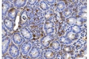 IHC analysis of CD20/MS4A1 using anti-CD20/MS4A1 antibody (ABIN7599223). (CD20 antibody  (AA 1-291))