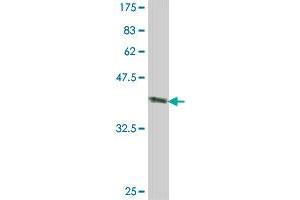 Western Blot detection against Immunogen (37.