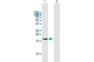 Western Blot analysis of BST2 expression in transfected 293T cell line by BST2 MaxPab polyclonal antibody. (BST2 antibody  (AA 40-180))