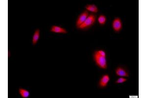 MCF-7 cells were stained with SKP2 Polyclonal Antibody, Unconjugated at 1:500 in PBS and incubated for two hours at 37°C followed by Goat Anti-Rabbit IgG (H+L) Cy3 conjugated secondary antibody. (SKP2 antibody  (AA 351-424))