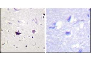 Immunohistochemistry analysis of paraffin-embedded human brain tissue, using PAK1/2/3 (Ab-144/141/139) Antibody. (PAK1/2/3 antibody  (AA 111-160))