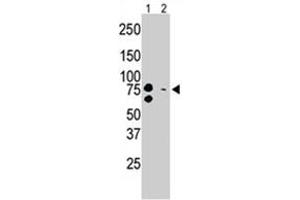 The BRD3 polyclonal antibody  is used in Western blot to detect BRD3 in mouse brain tissue lysate (Lane 1) and Sacs-2 cell lysate. (BRD3 antibody  (C-Term))