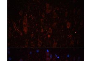 Immunofluorescence analysis of Rat brain using LAMC1 Polyclonal Antibody at dilution of 1:100. (Laminin gamma 1 antibody)
