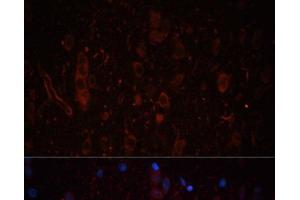 Immunofluorescence analysis of Rat brain using LAMC1 Polyclonal Antibody at dilution of 1:100. (Laminin gamma 1 antibody)