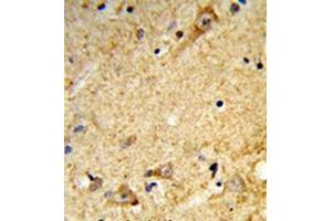 Immunohistochemistry analysis in formalin-fixed and paraffin-embedded human brain tissue reacted with Tricellulin Antibody (C-term) followed which was peroxidase-conjugated to the secondary antibody, followed by DAB staining. (Tricellulin antibody  (C-Term))