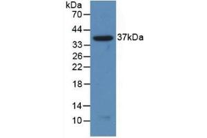 Western Blotting (WB) image for anti-Nuclear Factor of kappa Light Polypeptide Gene Enhancer in B-Cells 2 (NFKB2) (AA 38-343) antibody (ABIN7437092)