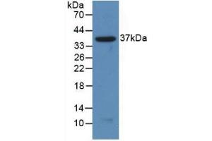 Detection of Recombinant NFkB2, Human using Polyclonal Antibody to Nuclear Factor Kappa B2 (NFkB2) (Nuclear Factor kappa B2 (AA 38-343) antibody)