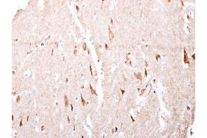 IHC-P Image GABA B Receptor 1 antibody [N2C1], Internal detects GABA B Receptor 1 protein at cytosol on human brain by immunohistochemical analysis. (GABBR1 antibody)
