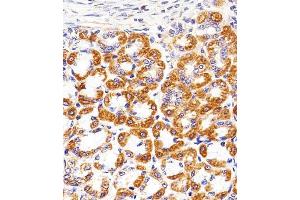 Immunohistochemical analysis of paraffin-embedded R. (Cytochrome C1 antibody  (AA 142-176))