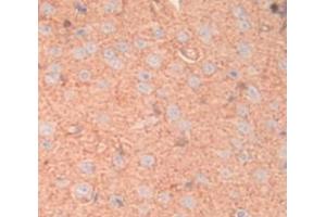 Figure. (MGP antibody  (AA 20-103))