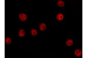 ABIN6274379 staining COLO205 cells by IF/ICC. (MAPKAP Kinase 3 antibody  (C-Term))