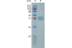 UL16 Binding Protein 2 (ULBP2) (AA 26-216) protein (His tag)