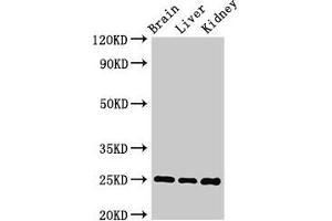 Western Blot Positive WB detected in: Mouse brain tissue, Mouse liver tissue, Mouse kidney tissue All lanes: VAMP7 antibody at 2 μg/mL Secondary Goat polyclonal to rabbit IgG at 1/50000 dilution Predicted band size: 25, 31, 21 kDa Observed band size: 25 kDa (VAMP7 antibody  (AA 2-186))