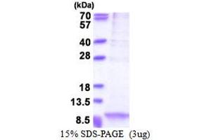 Apolipoprotein C-I (APOC1) (AA 27-83) protein (His tag)