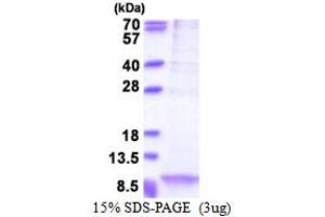 SDS-PAGE (SDS) image for Apolipoprotein C-I (APOC1) (AA 27-83) protein (His tag) (ABIN5853538)
