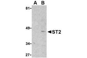 Image no. 1 for anti-Interleukin 1 Receptor-Like 1 (IL1RL1) (N-Term) antibody (ABIN206539)