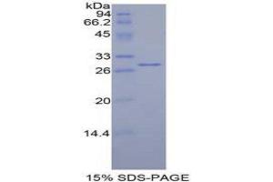 SDS-PAGE (SDS) image for E3 ubiquitin-protein ligase MIB2 (MIB2) (AA 546-784) protein (His tag) (ABIN1878522)
