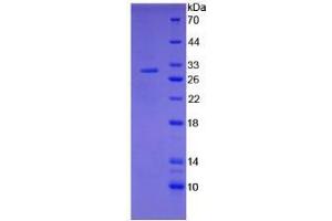 Image no. 1 for Coagulation Factor III (thromboplastin, Tissue Factor) (F3) (AA 30-252) (Active) protein (His tag) (ABIN6239858) (Tissue factor Protein (AA 30-252) (His tag))