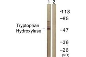 Western blot analysis of extracts from Jurkat cells, using Tryptophan Hydroxylase (Ab-260) Antibody. (Tryptophan Hydroxylase 1 antibody  (AA 231-280))