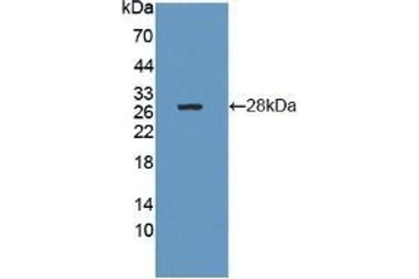 CTRB1 Antikörper  (AA 34-261)
