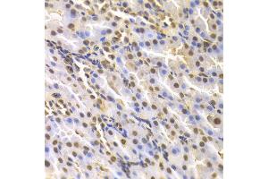Immunohistochemistry of paraffin-embedded rat kidney using DTNBP1 antibody at dilution of 1:100 (x400 lens). (DTNBP1 antibody)