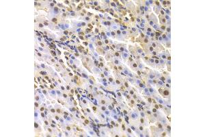 Immunohistochemistry of paraffin-embedded rat kidney using DTNBP1 antibody at dilution of 1:100 (x400 lens). (DTNBP1 antibody)