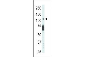 Antibody is used in Western blot to detect STK9 in mouse lung tissue lysate. (CDKL5 antibody  (C-Term))