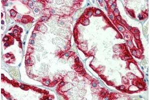 Kidney, Human: Formalin-Fixed, Paraffin-Embedded (FFPE) (Cytokeratin 18 antibody)