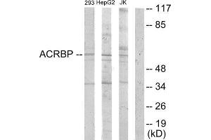 Western Blotting (WB) image for anti-Acrosin Binding Protein (ACRBP) (Internal Region) antibody (ABIN1849785) (ACRBP antibody  (Internal Region))