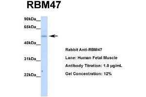 Host: Rabbit  Target Name: RBM47  Sample Tissue: Human Fetal Muscle  Antibody Dilution: 1. (RBM47 antibody  (Middle Region))