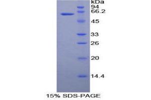 SDS-PAGE (SDS) image for Ribonuclease T2 (RNASET2) (AA 25-256) protein (His tag,GST tag) (ABIN1080671)