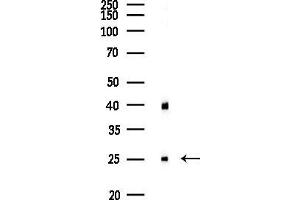 anti-FK506 Binding Protein 3, 25kDa (FKBP3) (Internal Region) antibody