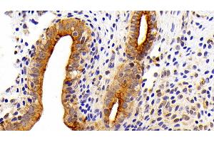 Detection of CK7 in Rat Uterus Tissue using Polyclonal Antibody to Cytokeratin 7 (CK7) (Cytokeratin 7 antibody  (AA 394-457))