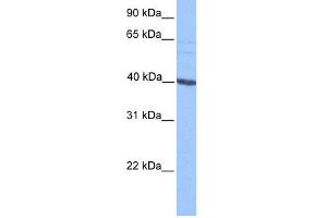 WB Suggested Anti-MLLT3 Antibody Titration:  0. (AF9 antibody  (C-Term))