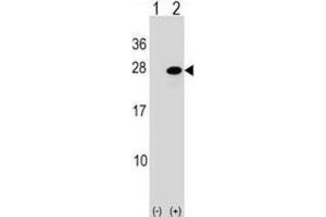 Western Blotting (WB) image for anti-Activating Transcription Factor 3 (ATF3) antibody (ABIN2998842) (ATF3 antibody)