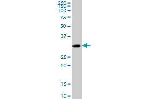 CENPH MaxPab rabbit polyclonal antibody. (CENPH antibody  (AA 1-247))