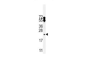 Western blot analysis in WiDr cell line lysates (35ug/lane). (FAM96A antibody  (C-Term))