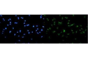 IF analysis of SAMHD1 using anti-SAMHD1 antibody (ABIN7601516). (SAMHD1 antibody  (AA 37-626))