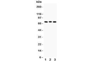 Western blot testing of PKC beta antibody and Lane 1:  rat brain;  2: mouse brain;  3: human COLO320. (Pkc beta 1 antibody  (AA 542-671))