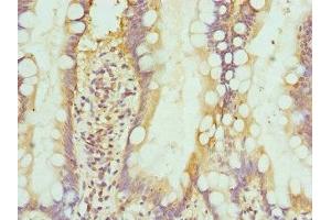 Immunohistochemistry of paraffin-embedded human small intestine tissue using ABIN7156393 at dilution of 1:100 (INTS1 antibody  (AA 451-710))