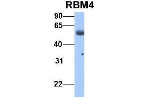 Host:  Rabbit  Target Name:  RBM4  Sample Type:  Human Adult Placenta  Antibody Dilution:  1.