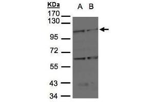 WB Image Sample(30 μg of whole cell lysate) A:H1299 B:Raji , 7. (BMPR2 antibody  (C-Term))