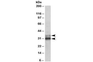 Western blot testing of human colon lysate with ETFA antibody at 0. (ETFA antibody)