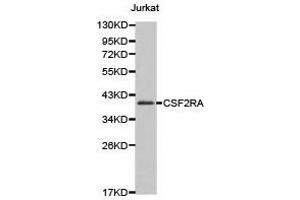 Western Blotting (WB) image for anti-Colony Stimulating Factor 2 Receptor, Alpha, Low-Affinity (Granulocyte-Macrophage) (CSF2RA) antibody (ABIN1872028) (CSF2RA antibody)