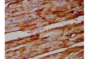 IHC image of ABIN7144635 diluted at 1:400 and staining in paraffin-embedded human skeletal muscle tissue performed on a Leica BondTM system. (ARRDC1 antibody  (AA 288-433))