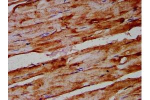 IHC image of ABIN7144635 diluted at 1:400 and staining in paraffin-embedded human skeletal muscle tissue performed on a Leica BondTM system.