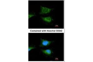 ICC/IF Image Immunofluorescence analysis of methanol-fixed HeLa, using GBA, antibody at 1:100 dilution. (GBA antibody  (C-Term))